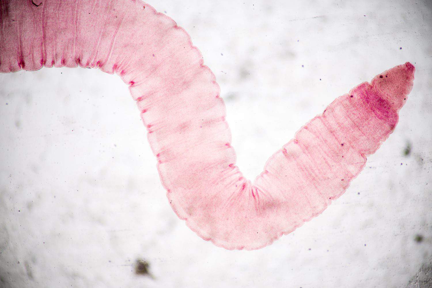 Raillietina echinobothrida is a parasitic tapeworm belonging to the class Cestoda.