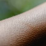 Goosebumps Are an Evolutionary Vestige