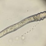 Your Face is Most Likely Crawling with Mites