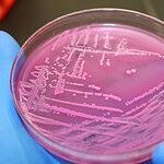 McDonald's Quarter Pounder E. coli Lawsuits