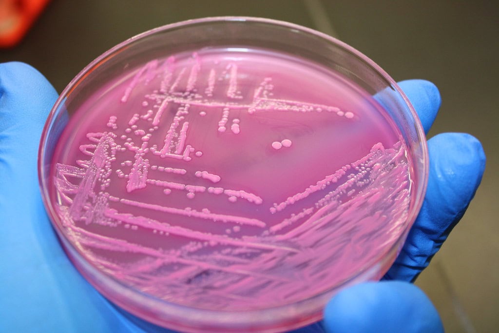 McDonald's Quarter Pounder E. coli Lawsuits