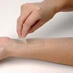 Mussel-Inspired Medical Adhesives