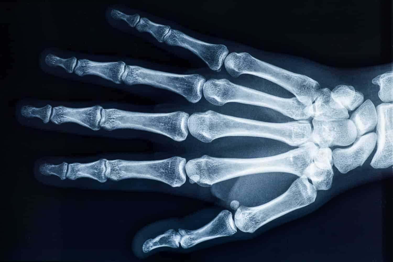 A particular fungus may help maintain bone density for astronauts in space.