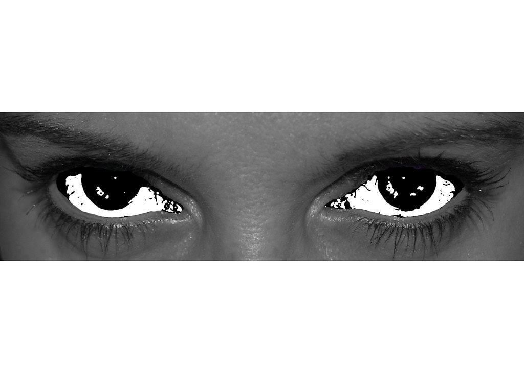 black eyes